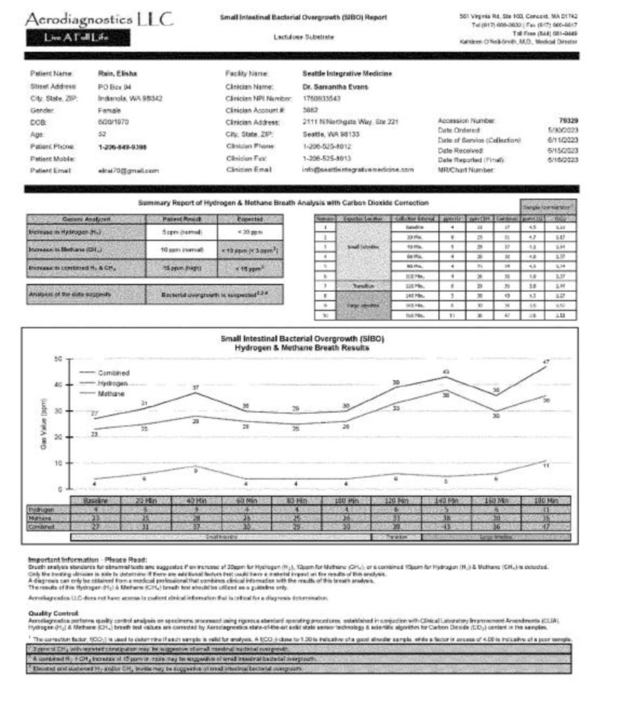 SIBO breath test results